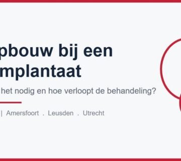 Wanneer is botopbouw nodig voor een tandimplantaat?