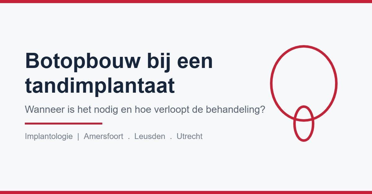 Wanneer is botopbouw nodig voor een tandimplantaat?